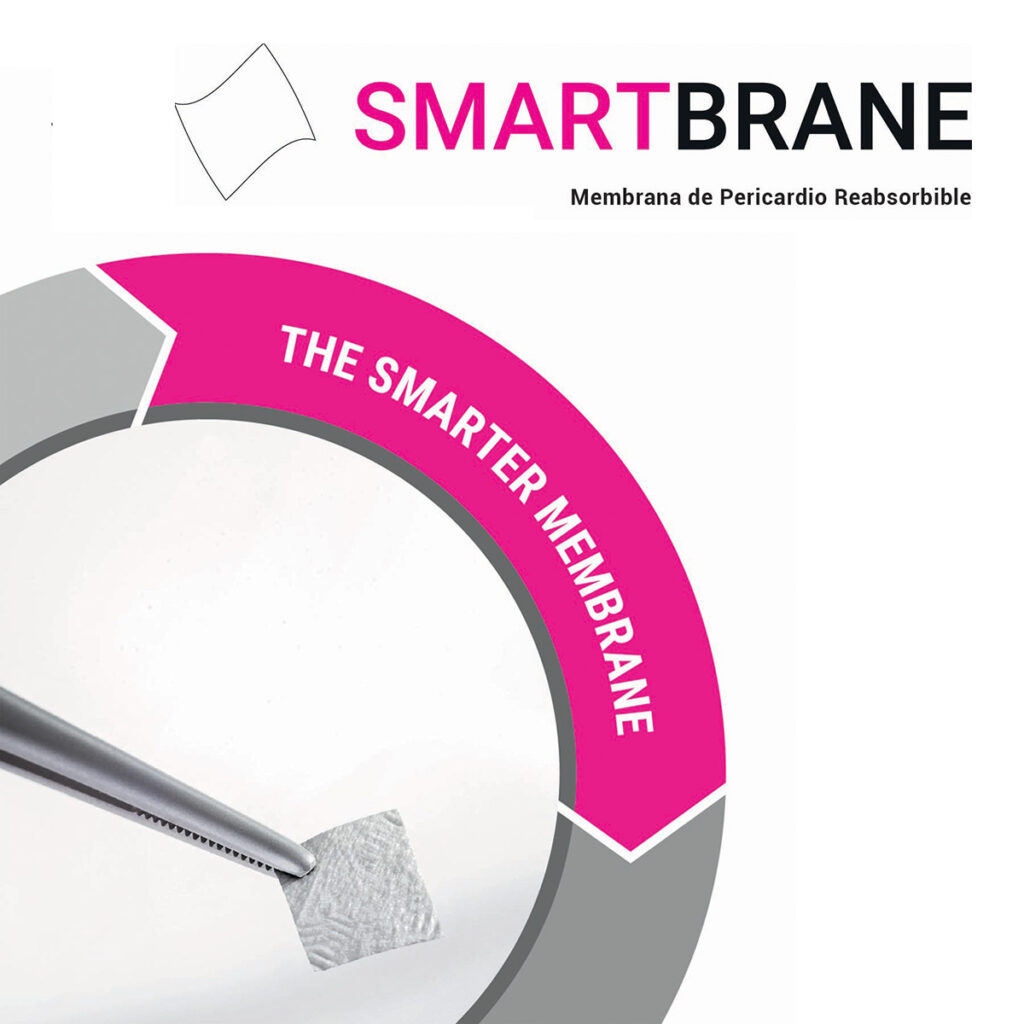 Smart Brane